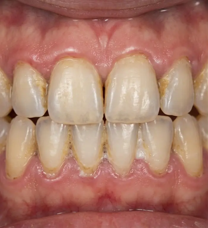 До процедури